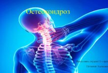 Photo of Инновационные методы борьбы с остеохондрозом: физиотерапия и массаж