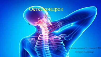 Photo of Инновационные методы борьбы с остеохондрозом: физиотерапия и массаж