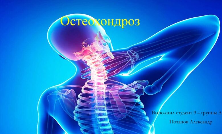Photo of Инновационные методы борьбы с остеохондрозом: физиотерапия и массаж