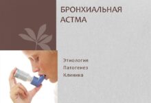 Photo of Профилактика астмы: важные меры для здоровья дыхательной системы