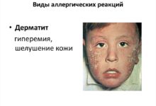 Photo of Как избежать аллергических реакций в быту