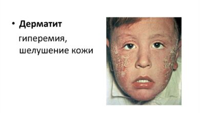 Photo of Как избежать аллергических реакций в быту