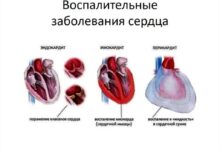 Photo of Сердечно-сосудистые заболевания: как избежать проблем
