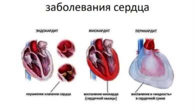Photo of Сердечно-сосудистые заболевания: как избежать проблем