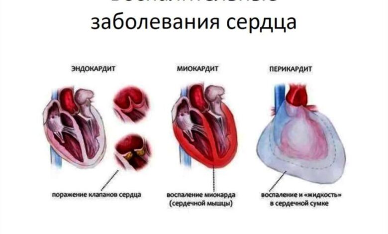 Photo of Сердечно-сосудистые заболевания: как избежать проблем